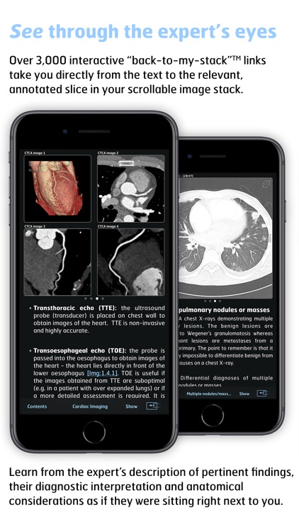 Thoracic Imaging Fundamentals screenshot-3