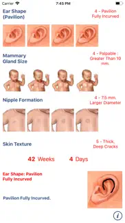 neonatology: test capurro iphone screenshot 2