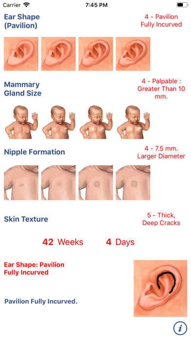 Neonatology: Test Capurro Screenshot