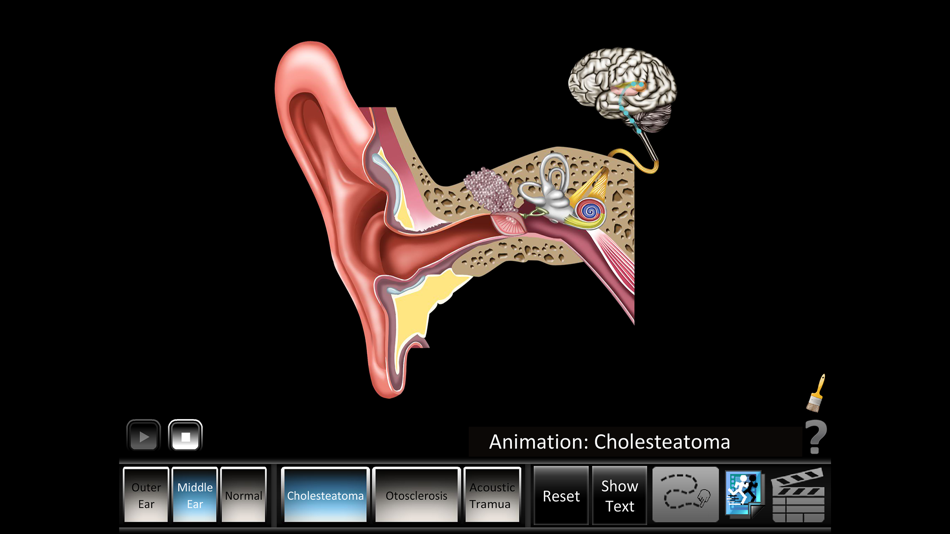 #5. Ear Disorders: Outer Middle (iOS) 由: Blue Tree Publishing, Inc.