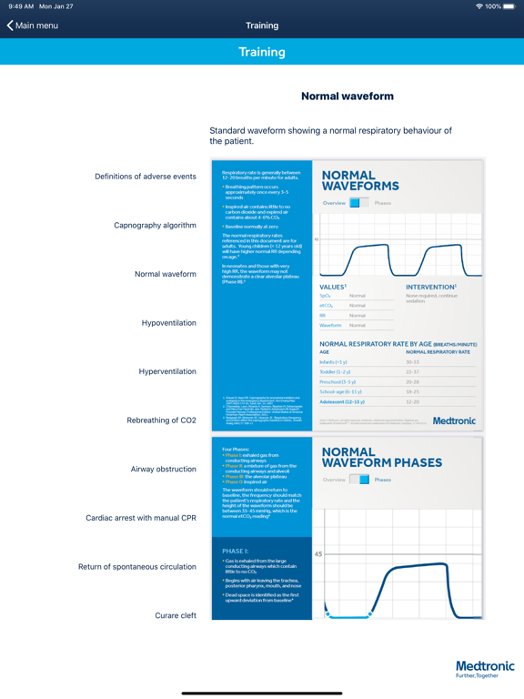 Screenshot #6 pour Microstream™ Sedation Data
