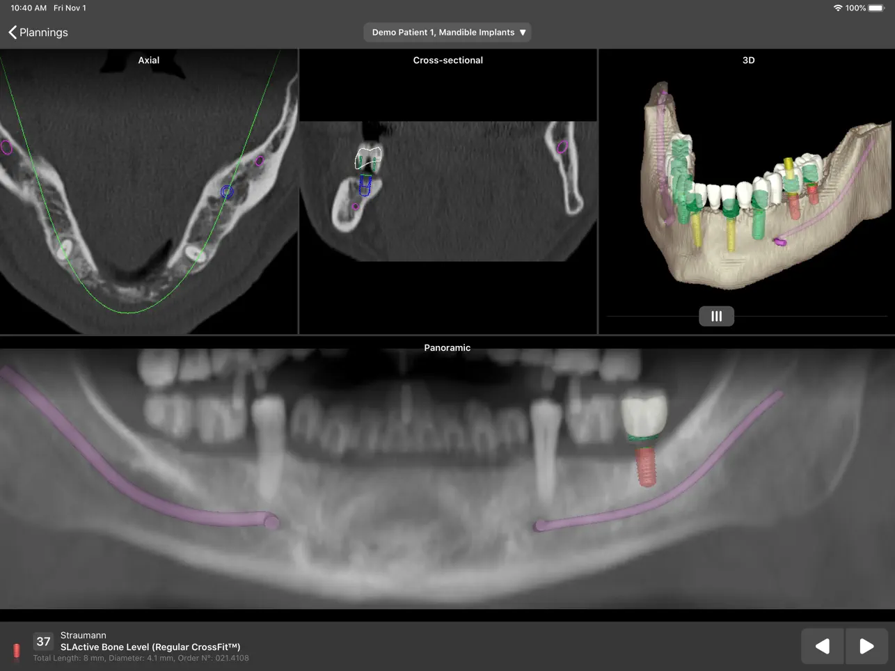 Screenshot #5 pour coDiagnostiX