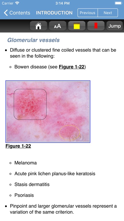 Dermoscopy Criteria Review screenshot-5