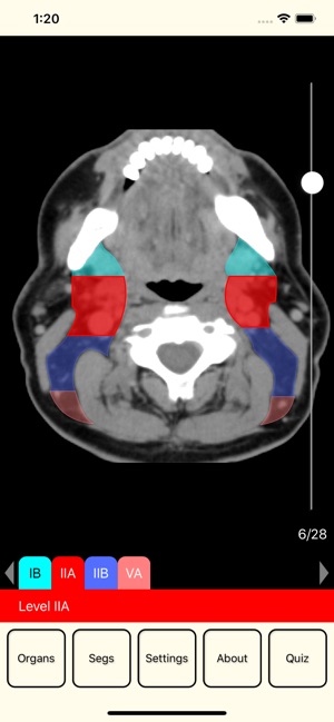 RadAnatomy(圖3)-速報App