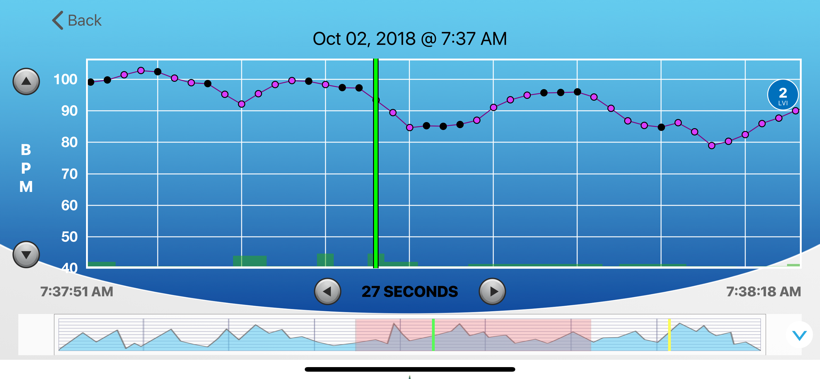 HRV Trace screenshot 2