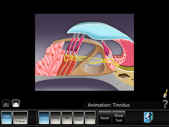 Screenshot #4 pour Ear Disorders: Inner