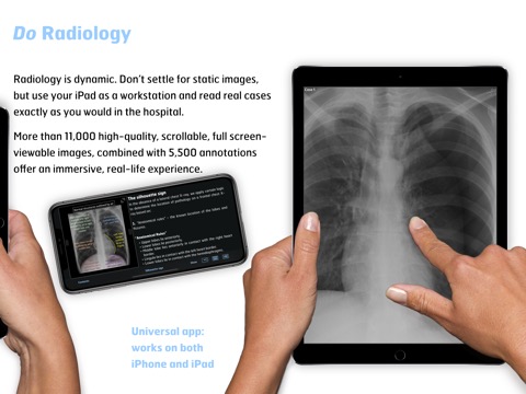 Thoracic Imaging Fundamentalsのおすすめ画像3