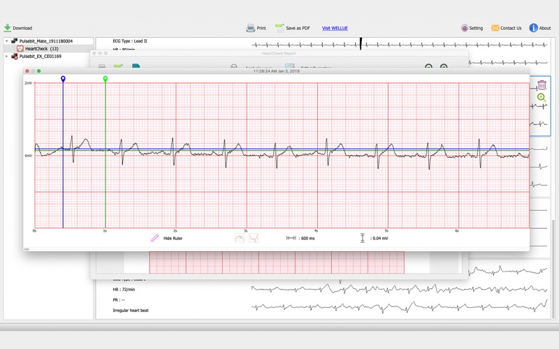 Pulsebit Browser Pro Apps 148Apps