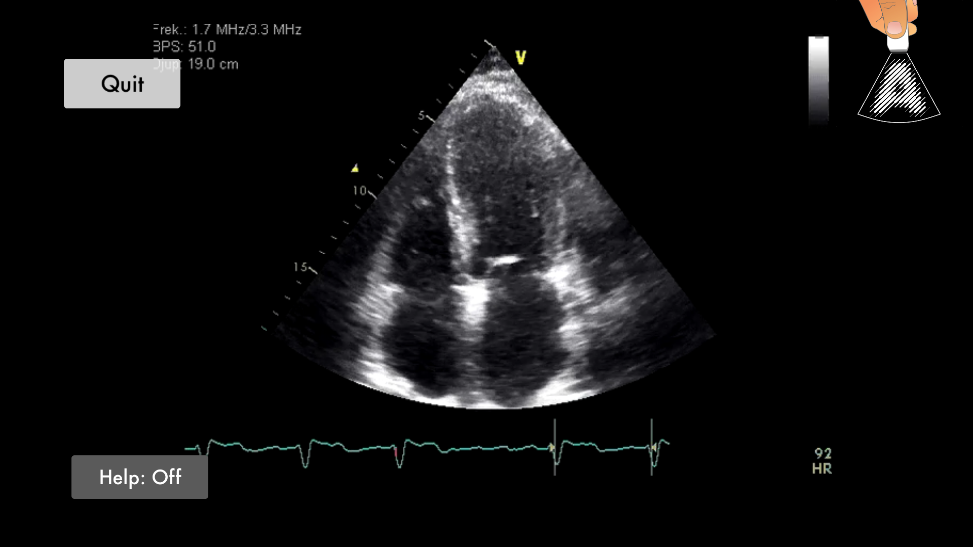 Awesome Ultrasound Simulator