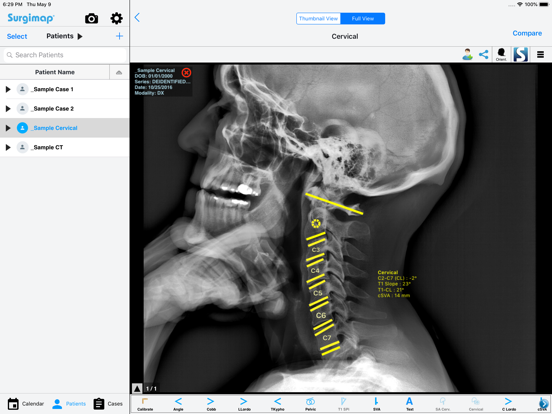 Screenshot #6 pour Surgimap
