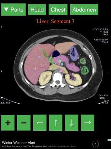 Anatomy on Radiology CTのおすすめ画像1