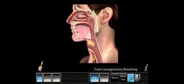 Game screenshot Laryngectomy mod apk