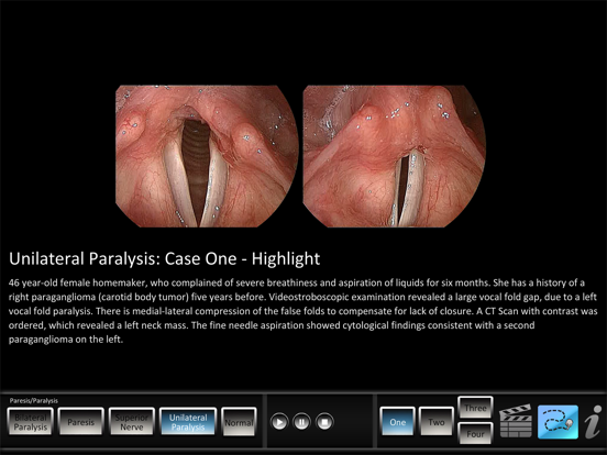 Screenshot #5 pour Paresis/Paralysis