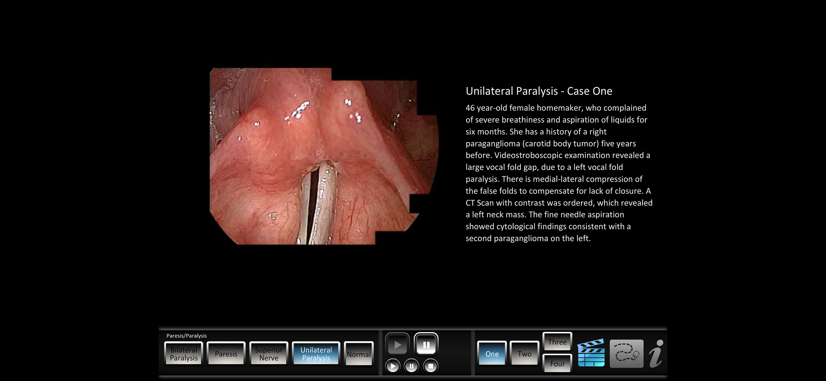 Paresis/Paralysis screenshot 3