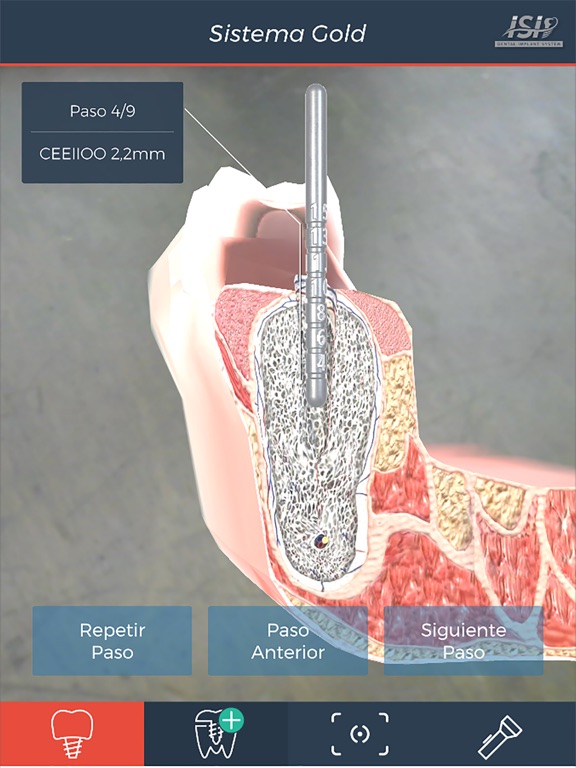 Screenshot #5 pour ISI Dental