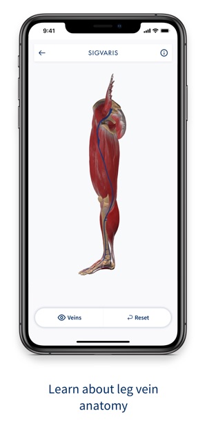 SIGVARIS GROUP Vein App(圖1)-速報App
