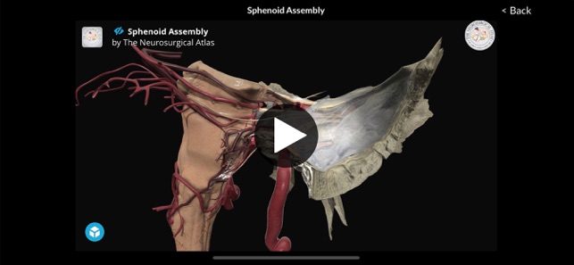 Neurosurgical Atlas(圖5)-速報App