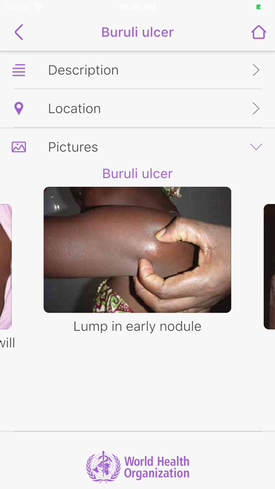 Skin NTDs App Screenshot