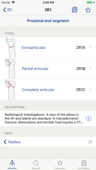 AO/OTA Fracture Classification Screenshot