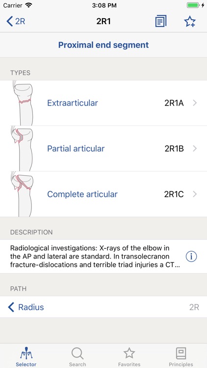 AO/OTA Fracture Classification