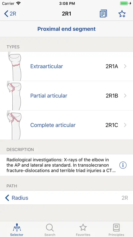 AO/OTA Fracture Classification screenshot 2 of 5