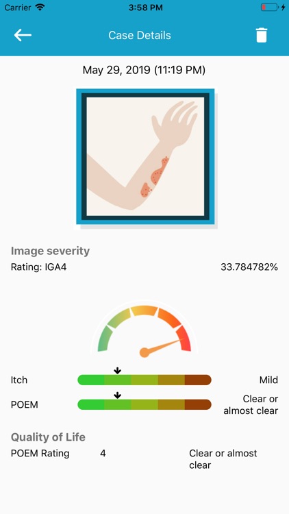 EczemaLess, an AI Eczema Guide screenshot-8