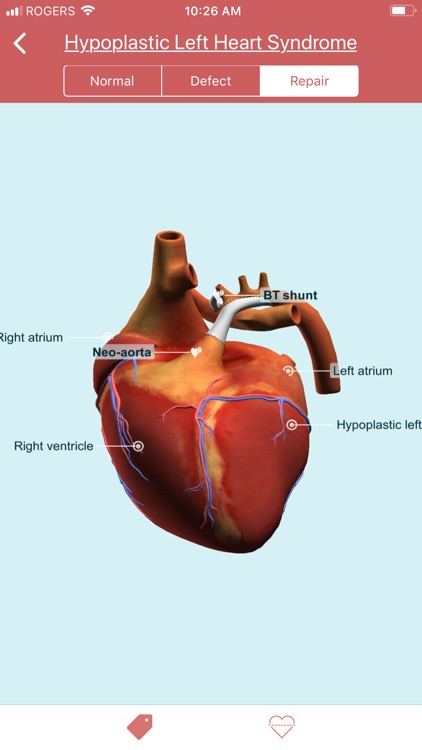 eMurmur Heartpedia