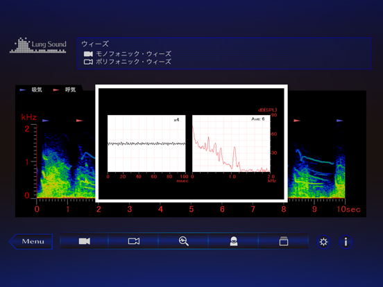 Screenshot #6 pour 肺の聴診トレーニング - 見える肺音