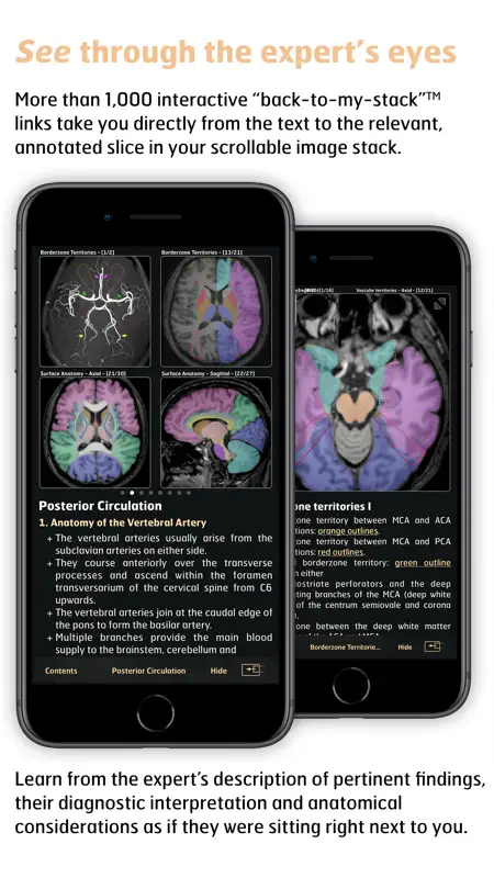 Radiology - Imaging in Stroke screenshot 4 of 5