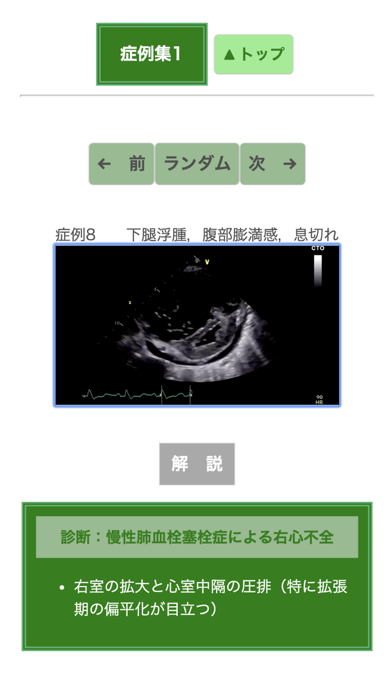 ポケット心エコー図のおすすめ画像5