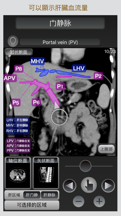 CT 护照 "腹部" screenshot