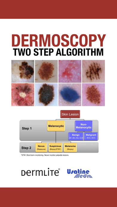 Dermoscopy Two Step Algorithm Screenshot