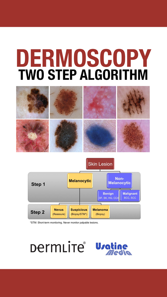 #1. Dermoscopy Two Step Algorithm (iOS) 게시자: Usatine & Erickson Media LLC