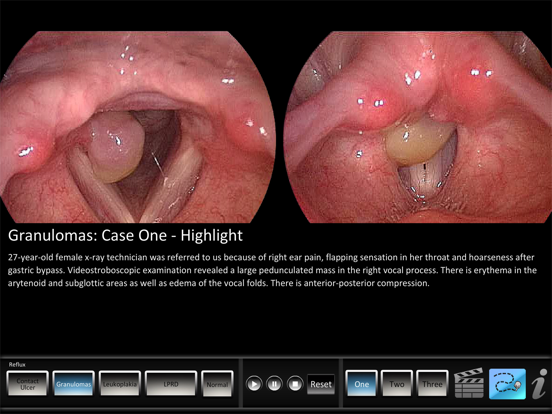 Screenshot #4 pour Vocal Pathology: Reflux