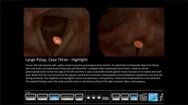 Game screenshot Vocal Pathology: Polyps hack