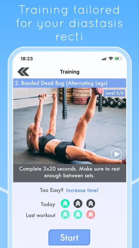 Diastasis Recti Fix