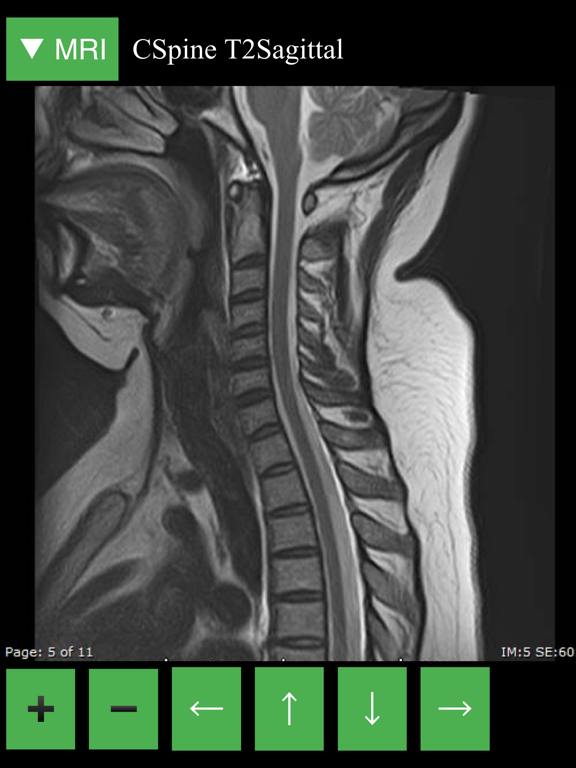 MRI Viewerのおすすめ画像3