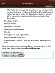 dermoscopy two step algorithm ipad bildschirmfoto 3