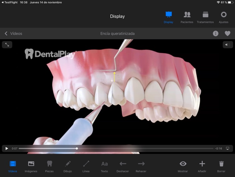 Dentool