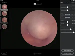 imagyn for iCare screenshot 2