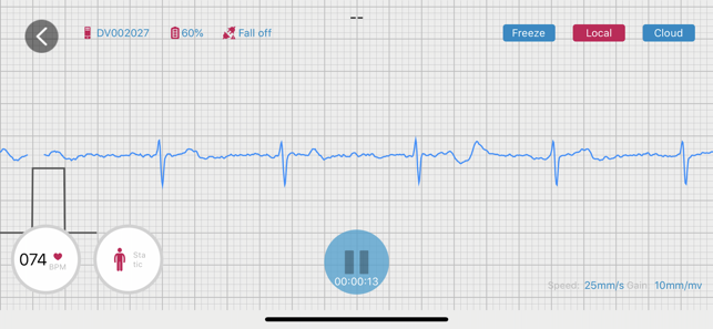 RhythmWatch Doctor(圖1)-速報App