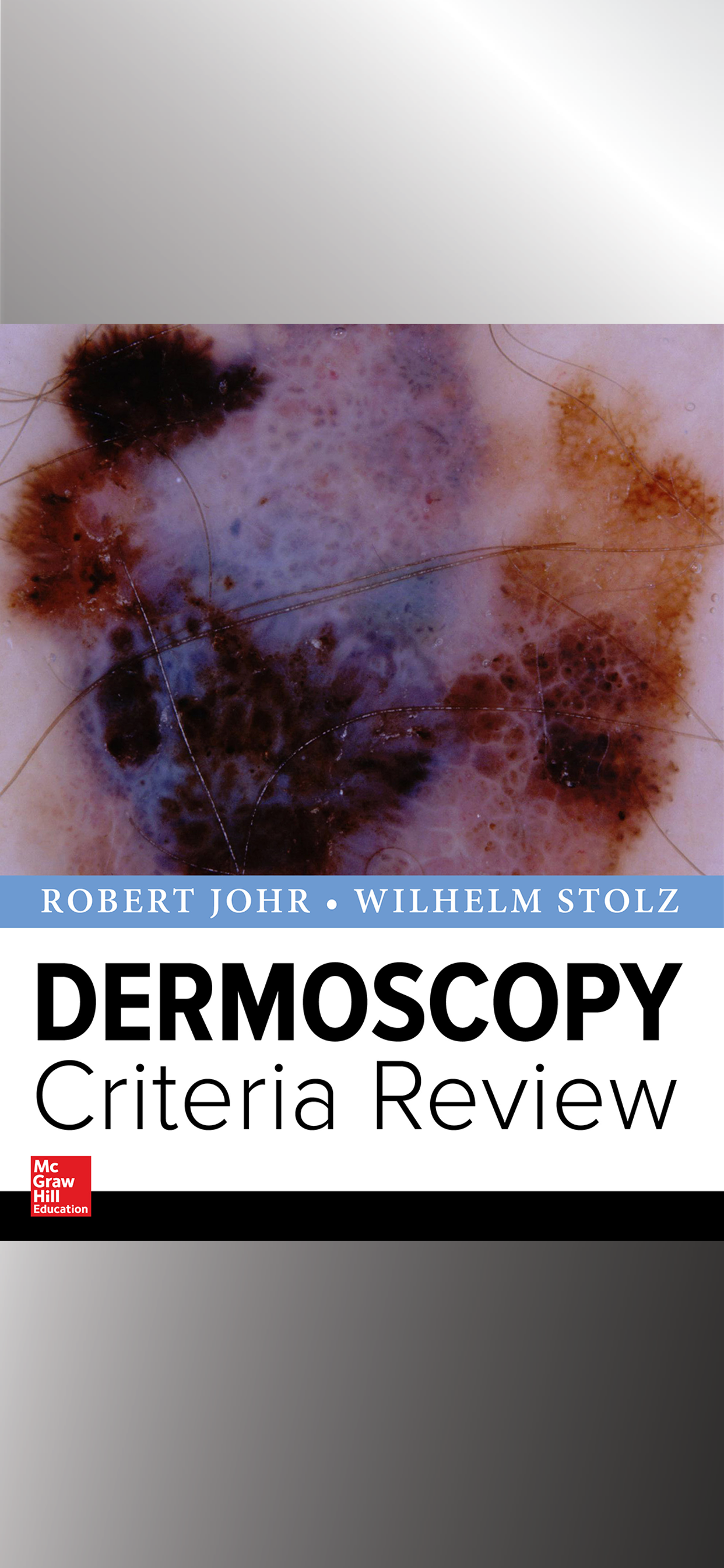 Dermoscopy Criteria Review