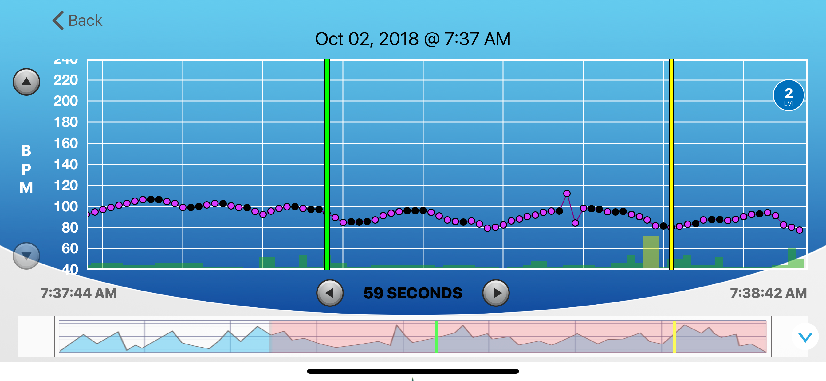 HRV Trace screenshot 3