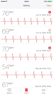cardiograph problems & solutions and troubleshooting guide - 4