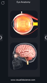 My Eye Anatomy screenshot