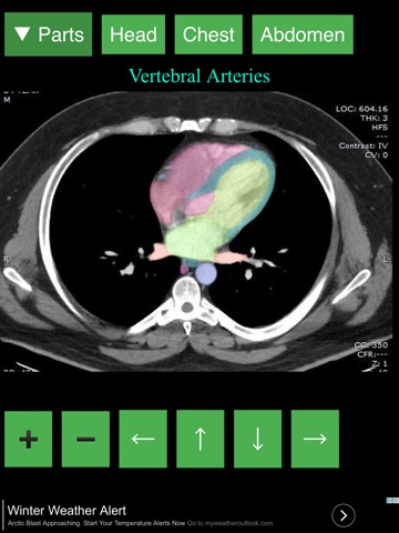 Anatomy on Radiology CTのおすすめ画像5