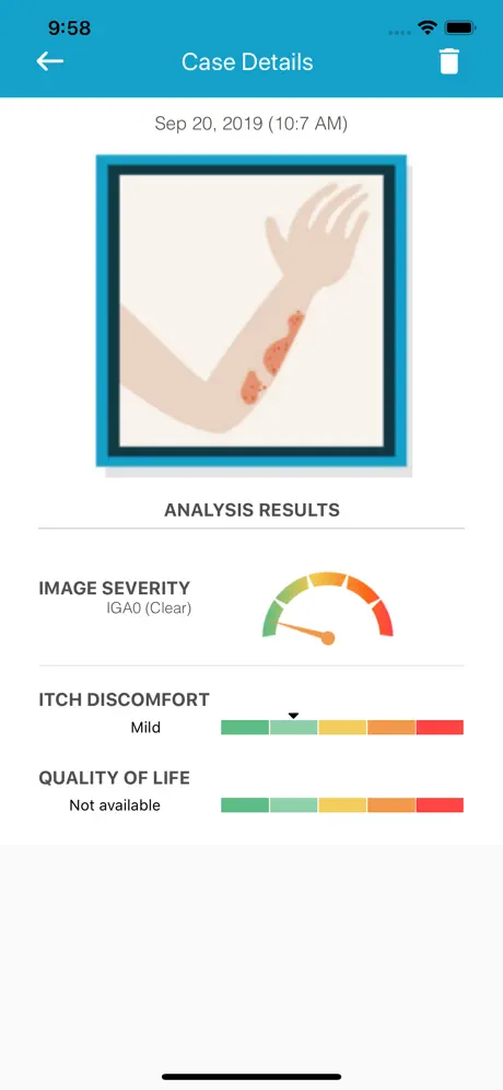 EczemaLess, an AI Eczema Guide