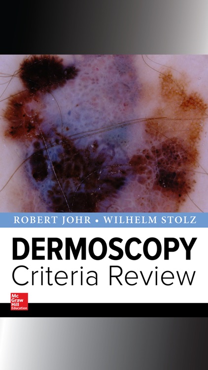 Dermoscopy Criteria Review