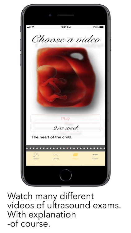 ScanBaby learn baby ultrasound screenshot-7