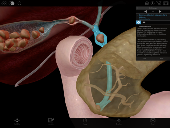 Physiology & Pathology iPad app afbeelding 5